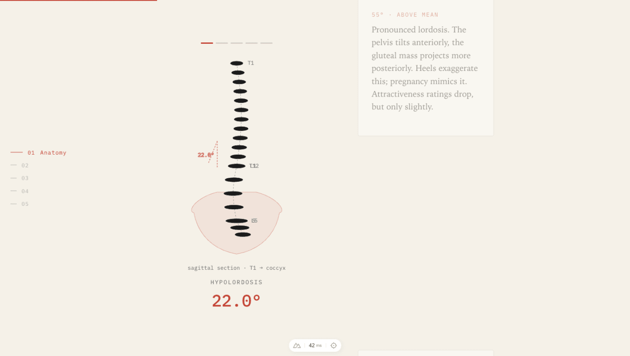 Explainer section: sagittal spine diagram with vertebrae, sacrum outline, and a 22.0-degree lumbar lordosis angle readout