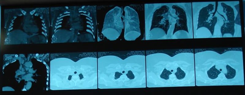 4 2 Бериллий чем опасен для человека