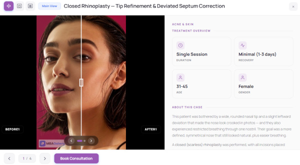 Interactive before and after comparison slider