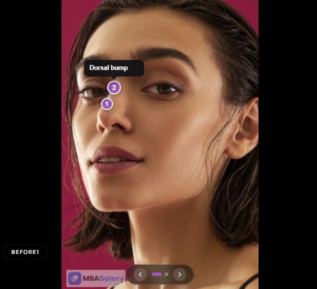 Numbered annotation hotspots on a before and after image