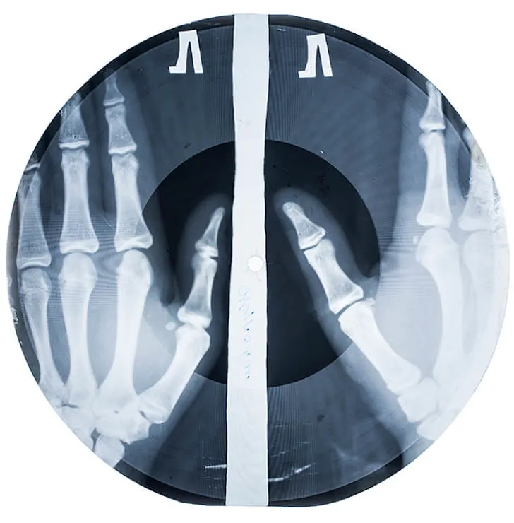 The X-ray Audio Project On Communism’s Blackmarket Bootlegs
