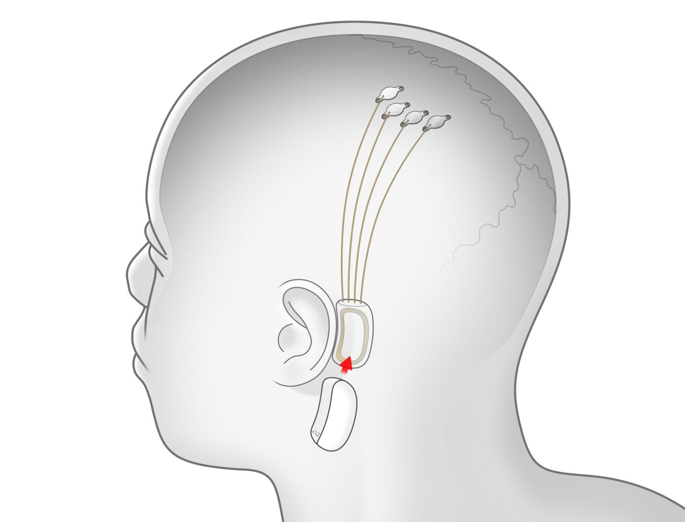 Elon Musk - Neuralink