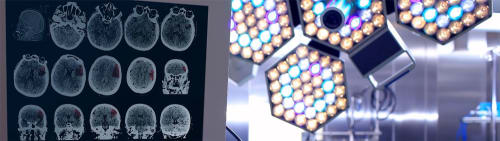 Medisinske skilletrafoer