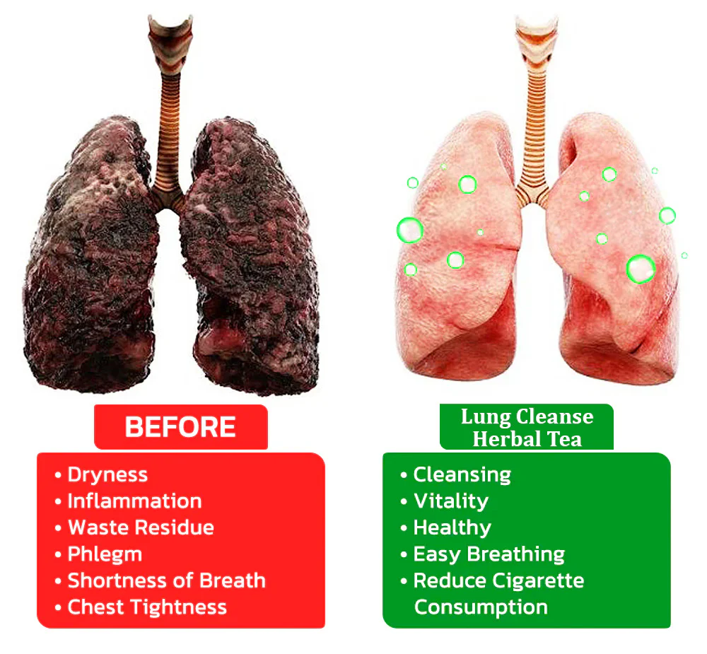Herbal Throat & Lung Cleanse Image Placeholder