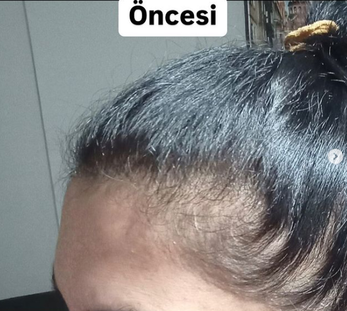 Ürün kullanımından sonraki görünüm
