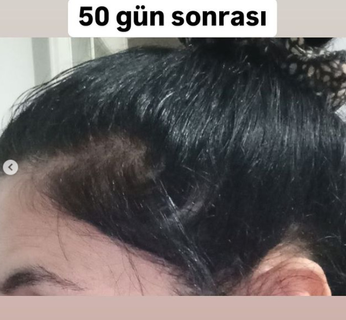 Ürün kullanımından önceki görünüm