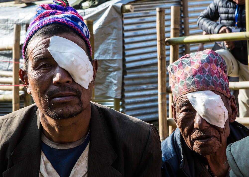 Two men after their cataract operations
