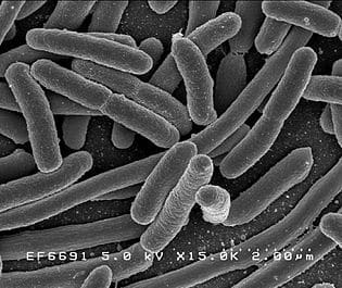 Can Nuclear Waste Be Neutralized by Bacteria?