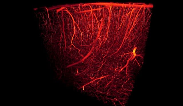 Modeling Fluid Flow Inside the Body