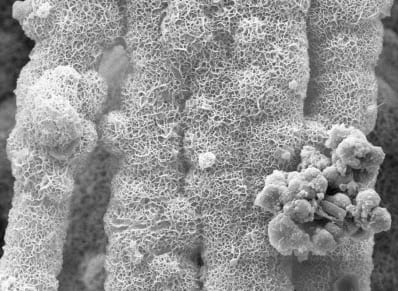 Concrete That Repairs its Own Cracks