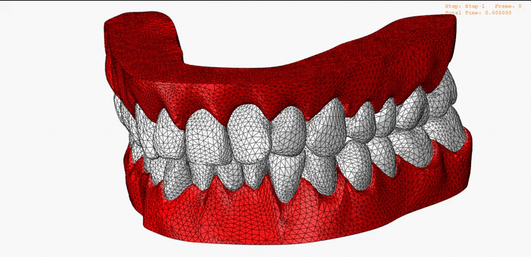 Jaw033115_ai1dt0.gif