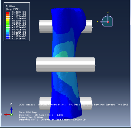 Partition a volume mesh (bone) - DASSAULT: ABAQUS FEA Solver - Eng-Tips