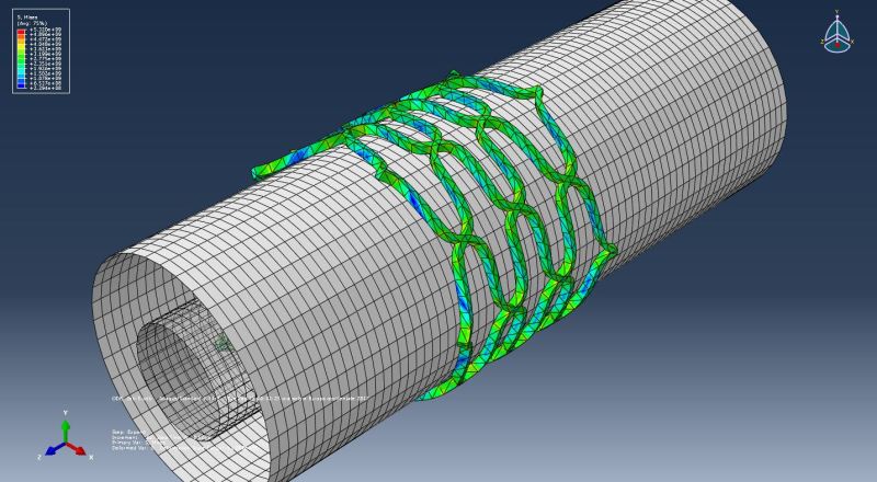 stent_open_3_egeyhi.jpg
