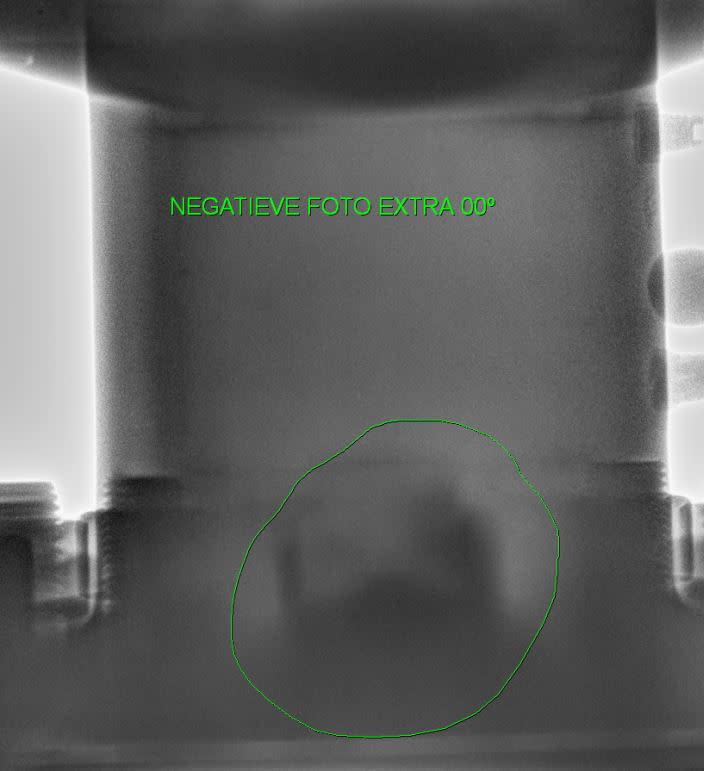 xray_ycldx5.jpg