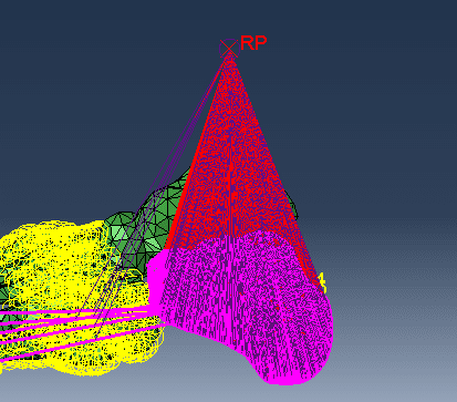 Abaqus - Mises Stress values are too high - Student Engineer General  Discussion - Eng-Tips