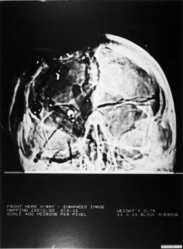 front_xtfuz7.jpg