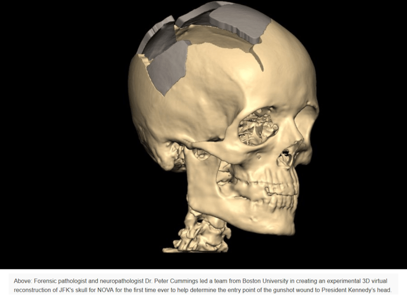 BU-Cranium-Model_gn0gy7.png