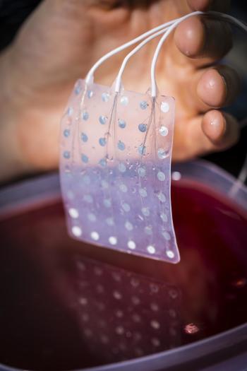 This type of electrocorticography (ECoG) grid, which is implanted in patients about to undergo epilepsy surgery, enables researchers to record and transmit electrical signals to and from the surface of the brain. (Image courtesy of Mark Stone/University of Washington.)