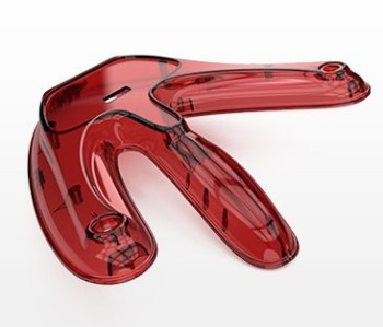Injection molded plastic part. (Image courtesy of Proto Labs.)
