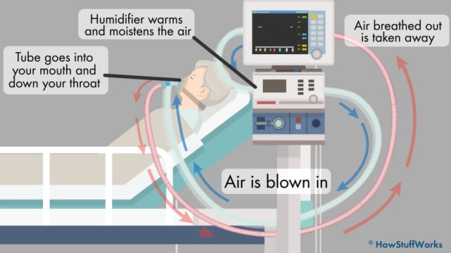 Process of ventilation. (Image courtesy of HowStuffWorks.)