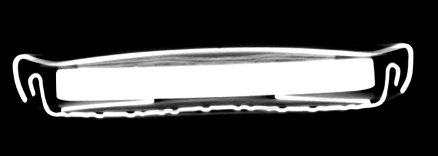 Slice from x-ray computed tomography image of a supercapacitor coin cell assembled with the electrode materials. The thin layers -- just below the coin cell lid -- are layers of electrode materials and a separator. (Image courtesy of William Kuykendall.)