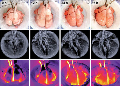 dead spacing in the lungs