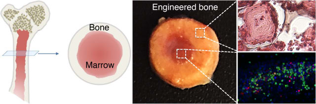 Left: Illustration of long bone structure. Center: Image of engineered bone with marrow. Right: High magnification images of bone tissue (top) and marrow cells (bottom). (Image courtesy of Varghese Lab/UC San Diego.)