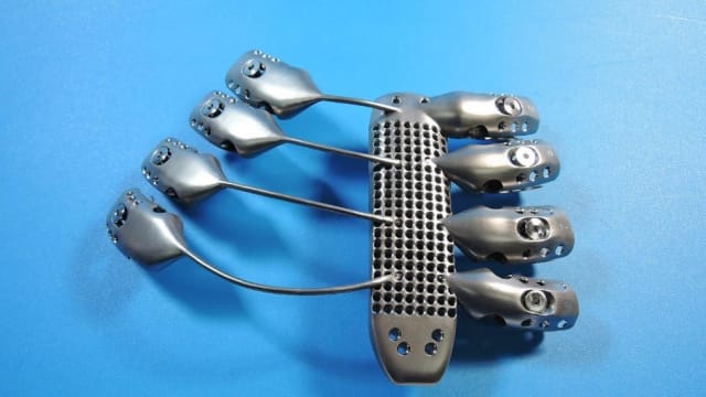 Stryker printed this titanium ribcage implant for a patient in 2015.