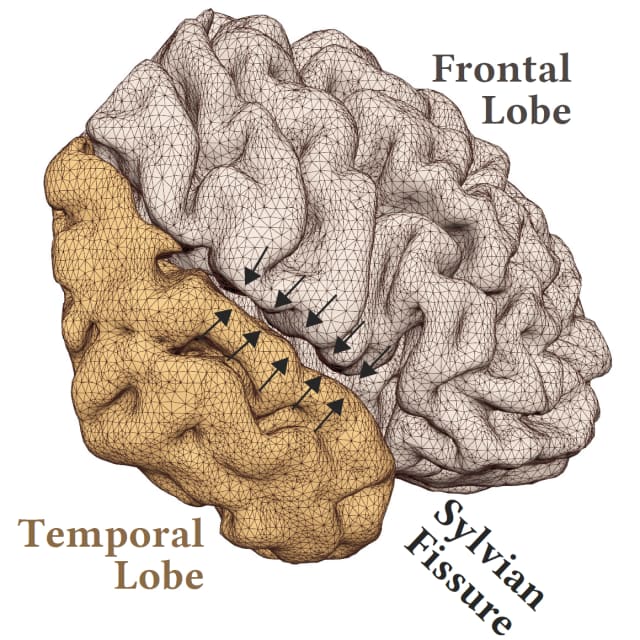 The Sylvian fissure separates the temporal and frontal lobes of the brain. (Image courtesy of Igarashi Lab, The University of Tokyo.)