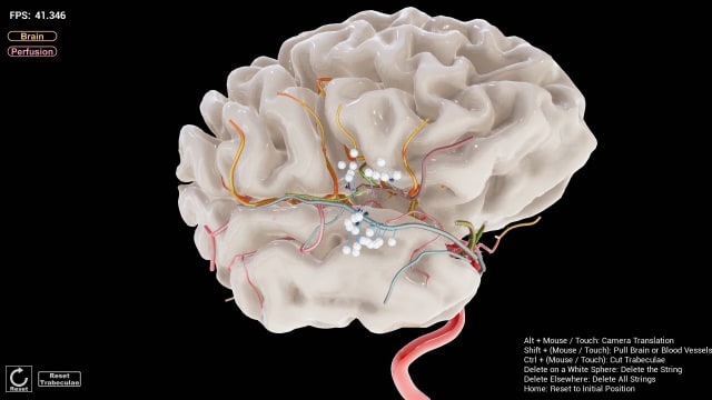 A simulated 3D model of a brain could help neurosurgeons practice the Transsylvian approach. (Image courtesy of Igarashi Lab, The University of Tokyo.)