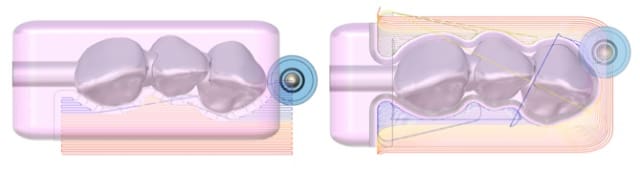 A parallel constant offset roughing toolpath (left) versusan adaptiveroughing toolpath (right), which is used for grinding out inlays, crowns, bridges and veneer components. (Image courtesy of ModuleWorks.)