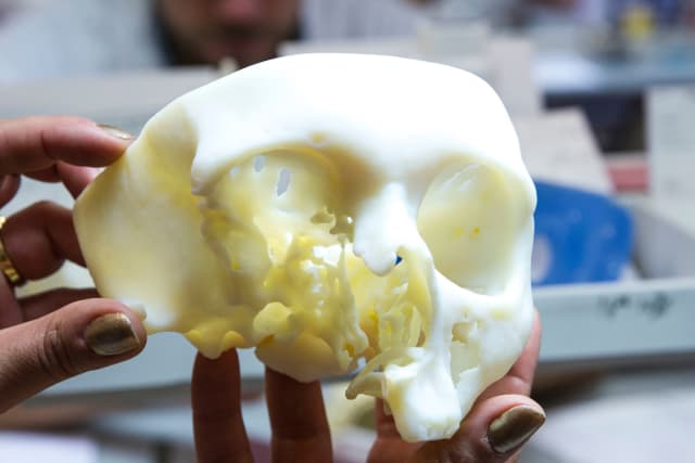 A 3D-printed skull model made using Mimics inPrint. (Image courtesy of Materialise.)