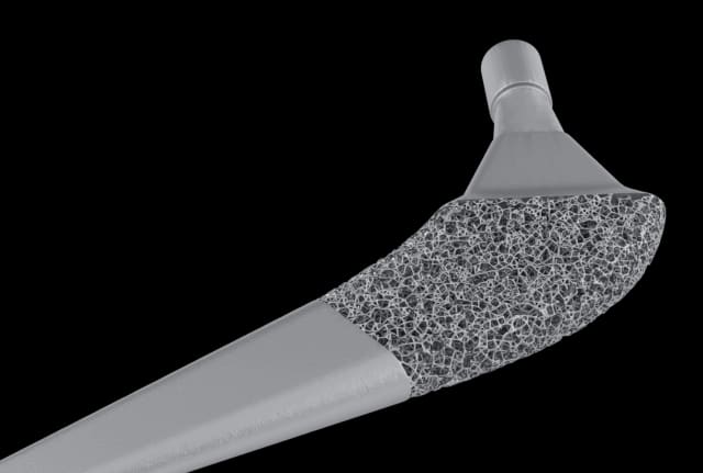 Getting close to nature: stochastic lattices with the Gen3D Sulis application. (Picture courtesy of Gen3D.)