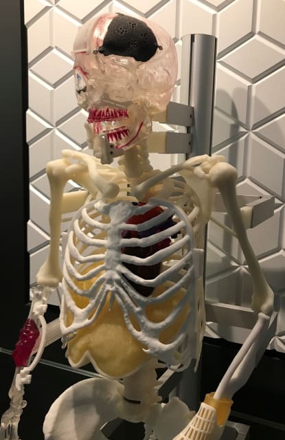 “Lucky,” victim of bone cancer, skull and wrist fractures, needy of jaw realignment, greets visitors at 3D Systems’ Denver area facility, an example of the company’s expertise in creating customized body parts.