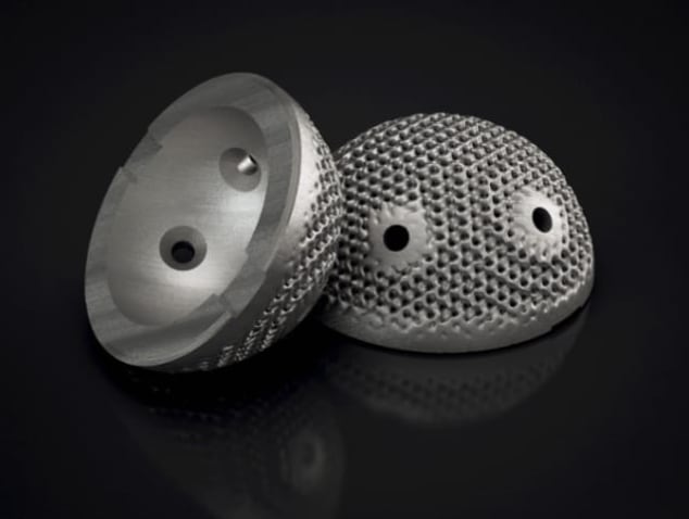 Figure 2. Surgical implant designed in Frustum (Image courtesy of Frustum.)