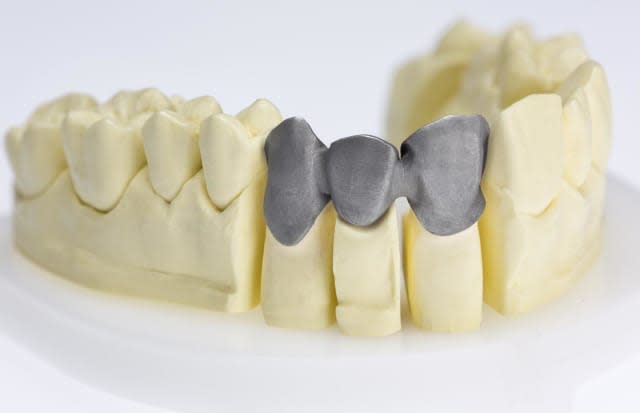 A bridge framework 3D-printed in CE-certified cobalt chrome with Renishaw’s LaserPFM dentistry 3D printing. (Image courtesy of Renishaw.)