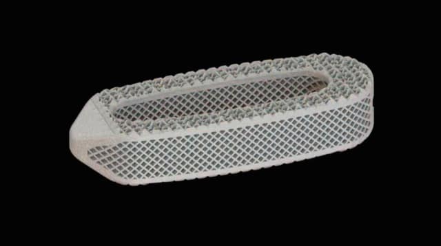 Osseus’s 3D-printed spinal implant, featuring proprietary topology and lattice design. (Image courtesy of Osseus Fusion Systems.)