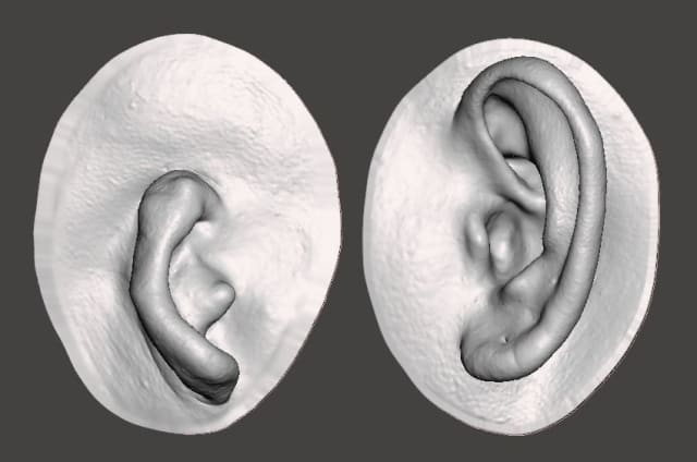 3D scan of microtia and human ear. (Image courtesy of CGTrader.)