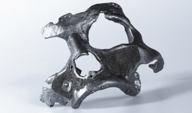 Figure 7. Face implant for a patient who suffered skull damage.(Image courtesy of Autodesk.)