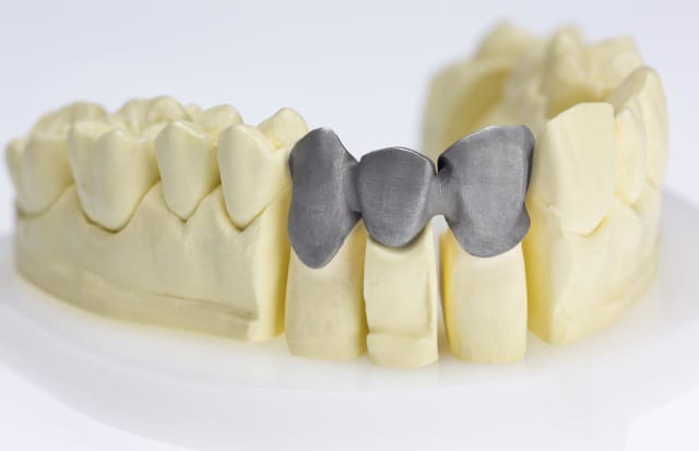 A bridge framework 3D-printed in CE-certified cobalt chrome with Renishaw’s LaserPFM dentistry 3D printing. (Image courtesy of Renishaw.)