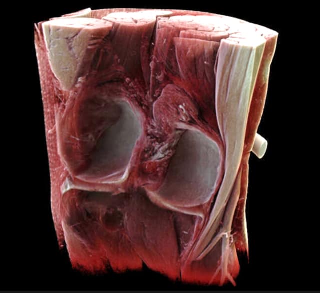 Figure 9.Cinematic VRT at work—weirdly hungry for oxtail soup right now. (Image courtesy of Siemens.)