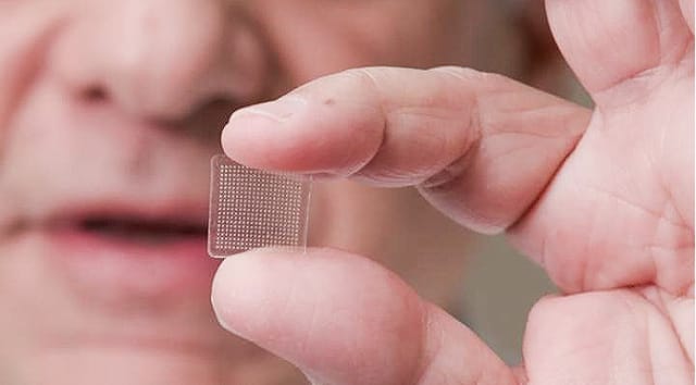 A 400-microneedle fingertip-sized patch made from sugar. (Image courtesy of Health Europa.)