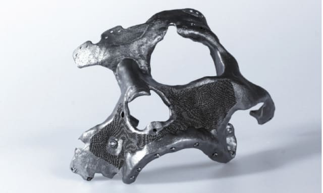 Autodesk Within Medical allows variable porosity and fine lattices to be generated based on the designer's requirements. This skull implant is optimised for weight and for compatibility with existing bone structure. (Image courtesy of Autodesk.)