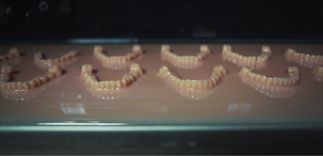 3D-printed models of patients’ teeth. (Image courtesy of Biotech Dental.)