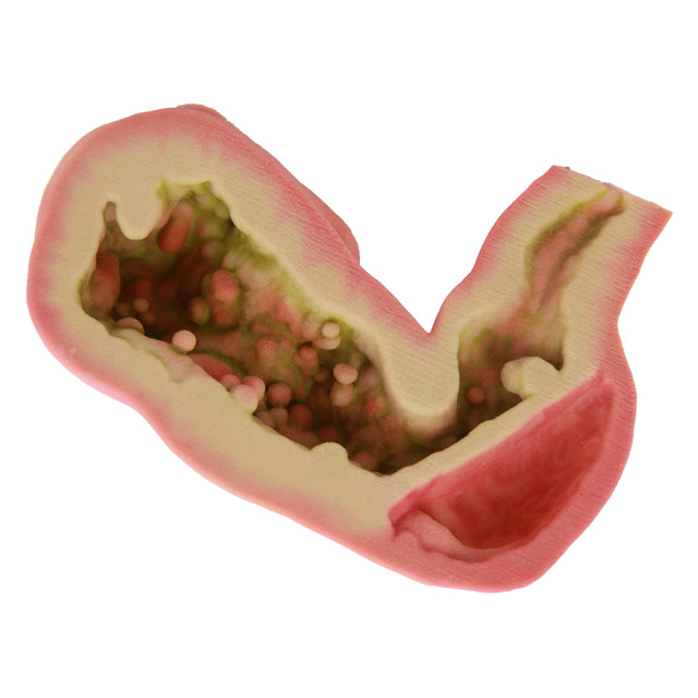 A 3D-printed bisectional model of a human stomach. (Image courtesy of WhiteClouds.)