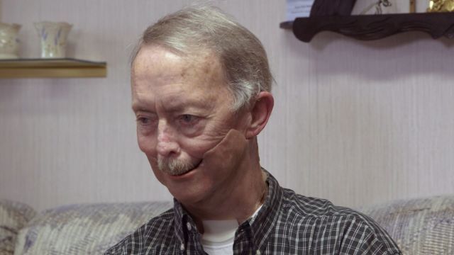 Shirley Anderson's life-like facial prosthetic was made with a 3D-printed mold. (Image courtesy of Formlabs.)