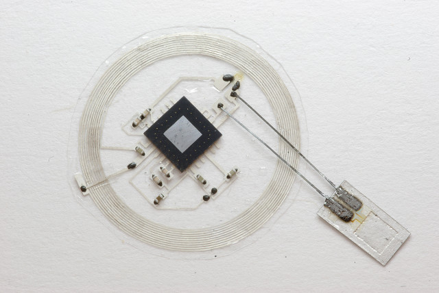 The small sensor connects to an embeddable wireless transmitter that lies on top of the skull. (Image courtesy of John A. Rogers.)