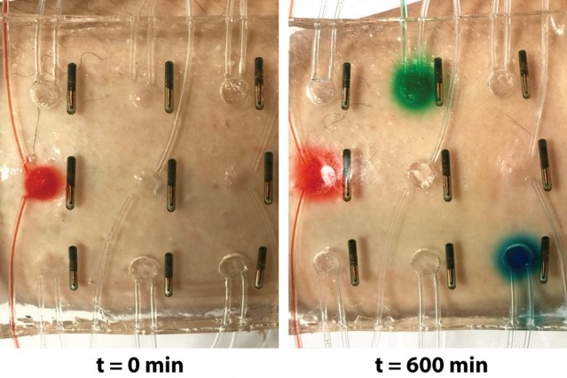 A stretchable, smart wound dressing includes temperature sensors and drug-delivery channels and reservoirs, embedded in a robust hydrogel matrix. Mock drugs can be released at various locations on demand, based on the measured temperatures. (Image courtesy of MIT.)
