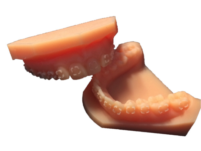 3D-printed dental model made with PLASTCure Model 300 resin. (Image courtesy of Prodways.)