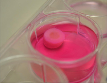 A plug of 3D-bioprinted cartilage on top of a plug of osteocondral material—bone and cartilage. The bone sits in a bath of nutrient media. (Image courtesy of Ozbolat/Penn State.)